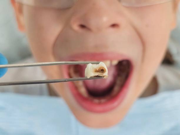 Best Weekend Emergency Dentist in St Paris, OH